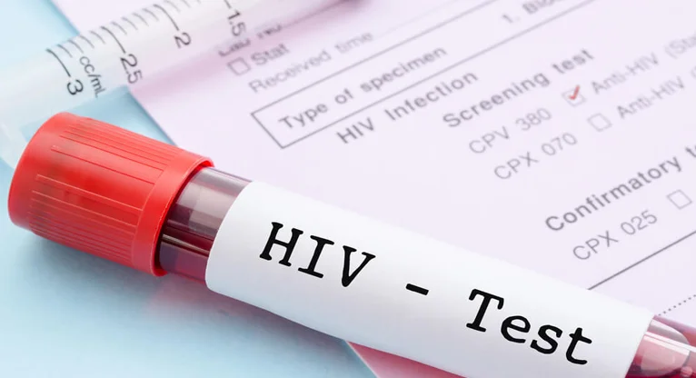 What is Anti-HIV Therapy?